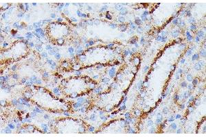 Immunohistochemistry of paraffin-embedded Rat kidney using IDH3A Polyclonal Antibody at dilution of 1:100 (40x lens).