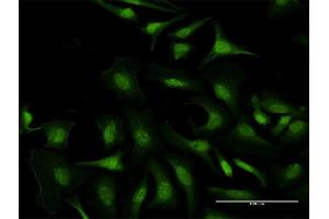 Immunofluorescence of purified MaxPab antibody to C5orf51 on HeLa cell.