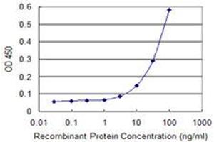 Detection limit for recombinant GST tagged IRF5 is 1 ng/ml as a capture antibody. (IRF5 antibody  (AA 1-498))