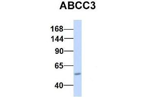 Host:  Rabbit  Target Name:  CHAD  Sample Type:  Human Adult Placenta  Antibody Dilution:  1. (ABCC3 antibody  (Middle Region))