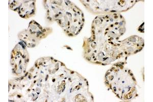 Anti- GRK5 Picoband antibody,IHC(P) IHC(P): Human Placenta Tissue (GRK5 antibody  (C-Term))