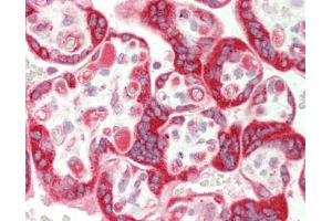 Human Placenta: Formalin-Fixed, Paraffin-Embedded (FFPE). (TRIP10 antibody  (AA 135-184))