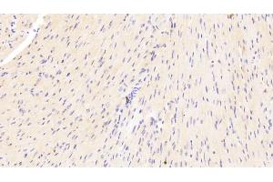 Detection of LAMa2 in Mouse Heart Tissue using Polyclonal Antibody to Laminin Alpha 2 (LAMa2) (Laminin antibody  (AA 2901-3106))