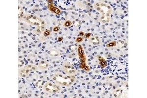 Immunohistochemistry analysis of paraffin-embedded mouse kidney using,SLC12A1 (ABIN7075651) at dilution of 1: 2000 (SLC12A1 antibody)