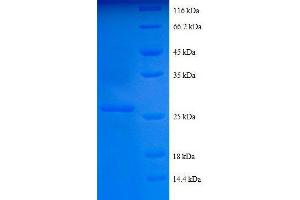 COL4a2 Protein (AA 1493-1712, partial) (His tag)
