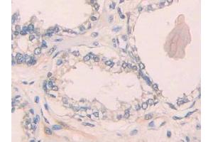 Used in DAB staining on fromalin fixed paraffin- embedded rectum cancer tissue (IL1R1 antibody  (AA 226-318))