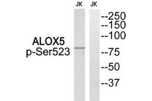 Western blot analysis of extracts from Jurkat cells, using ALOX5 (Phospho-Ser523) antibody. (ALOX5 antibody  (pSer523))