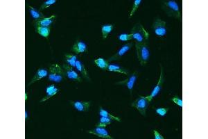 IF analysis of ANGPT2 using anti-ANGPT2 antibody (ABIN7601450). (Angiopoietin 2 antibody  (AA 357-404))