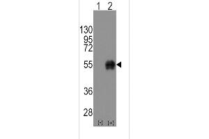 Western blot analysis of CD14 using rabbit polyclonal CD14 Antibody using 293 cell lysates (2 ug/lane) either nontransfected (Lane 1) or transiently transfected with the CD14 gene (Lane 2). (CD14 antibody  (C-Term))