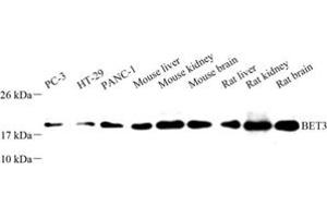 Western blot analysis of BET3 (ABIN7075949) at dilution of 1: 500 (TRAPPC3 antibody)