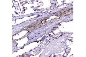 IHC analysis of PDE4D using anti-PDE4D antibody . (PDE4D antibody  (AA 466-709))