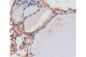 Used in DAB staining on fromalin fixed paraffin- embedded thyroid tissue (LRP1B antibody  (AA 31-194))