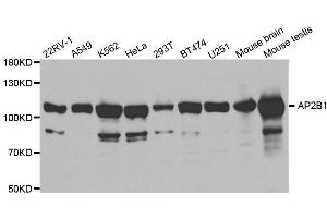 Western blot analysis of extracts of various cell lines, using AP2B1 antibody.