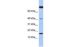 WB Suggested Anti-IL4 Antibody Titration: 0. (IL-4 antibody  (Middle Region))
