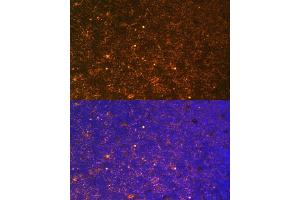 Immunofluorescence analysis of Rat thymus using CTGF antibody (ABIN6127716, ABIN6139187, ABIN6139190 and ABIN6215053) at dilution of 1:100. (CTGF antibody  (AA 27-349))