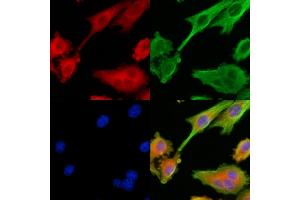 ABIN6264582 and ABIN6279743 staining HepG2 cells by IF/ICC. (RAB40C antibody  (C-Term))