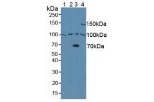 Western blot analysis of (1) Human Raji Cells, (2) Human Raw2647 Cells, (3) Human 293T Cells and (4) Mouse Pancreas Tissue. (ADAM8 antibody  (AA 145-493))