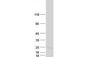 Western Blotting (WB) image for Ubiquitin-Conjugating Enzyme E2D 3 (UBE2D3) (Transcript Variant 1) protein (Myc-DYKDDDDK Tag) (ABIN2734798)