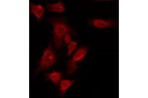 ABIN6275957 staining HuvEc by IF/ICC. (GPR150 antibody  (N-Term))