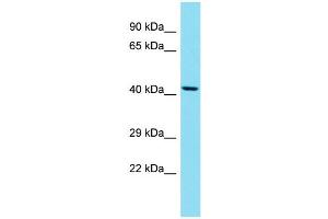 Western Blotting (WB) image for anti-Suppressor of Defective Silencing 3 Homolog (SUDS3) (N-Term) antibody (ABIN2788991) (SDS3 antibody  (N-Term))