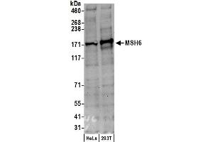 Western Blotting (WB) image for anti-MutS Homolog 6 (E. Coli) (MSH6) (AA 350-400) antibody (ABIN7454510)