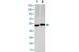 Western blot analysis using CA9 monoclonal antibody, clone 2D3  against HeLa (1) and A-549 (2) cell lysate.
