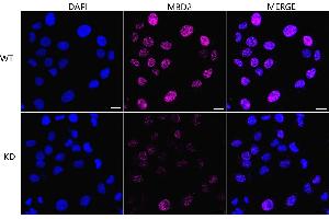 Immunocytochemical staining of HT- cells using MBD2 antibody (ABIN7799387), 1:1,000), Top panel: wild-type (WT), Bottom panal: MBD2 shRNA knockdown (KD). (Recombinant MBD2 antibody)