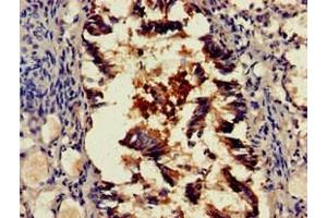 Immunohistochemistry of paraffin-embedded human lung tissue using ABIN7168699 at dilution of 1:100 (SCTR antibody  (AA 51-135))