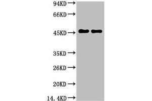 Western blot analysis of Rat Brain Tissue, diluted at 1:5000. (GFAP antibody)
