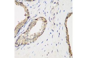 Immunohistochemistry of paraffin-embedded human prostate using METTL7A antibody. (METTL7A antibody  (AA 30-244))