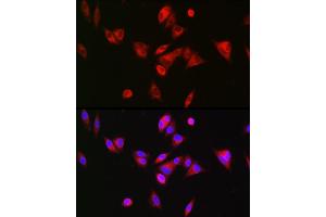 Immunofluorescence analysis of Hep G2 cells using BAAT Rabbit pAb (ABIN6131367, ABIN6137411, ABIN6137412 and ABIN6223563) at dilution of 1:200 (40x lens). (BAAT antibody  (AA 309-418))