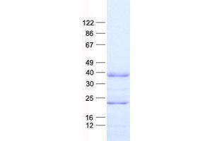 Validation with Western Blot (GNAT1 Protein (His tag))