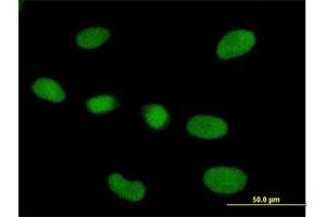 Immunofluorescence of purified MaxPab antibody to RPP40 on HeLa cell.