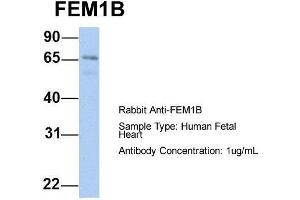 Host: Rabbit  Target Name: FEM1B  Sample Tissue: Human Fetal Heart  Antibody Dilution: 1. (FEM1B antibody  (C-Term))