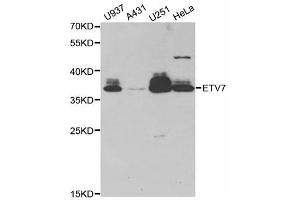 Western blot analysis of extracts of various cell lines, using ETV7 antibody (ABIN5973686) at 1/1000 dilution. (ETV7 antibody)