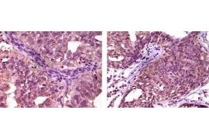 Immunohistochemistry (IHC) image for anti-Ephrin Type A Receptor 1 (EPHA1) antibody (ABIN1107101)