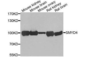 Western blot analysis of extracts of various cell lines, using SMYD4 antibody. (SMYD4 antibody  (AA 1-260))