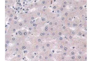 Detection of PLD in Human Liver Tissue using Polyclonal Antibody to Phospholipase D (PLD) (Phospholipase D antibody  (AA 725-1074))