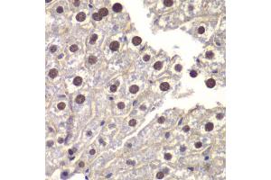 Immunohistochemistry of paraffin-embedded mouse liver using ST14 antibody (ABIN6293606) at dilution of 1:200 (40x lens). (ST14 antibody)