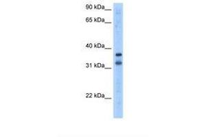Image no. 1 for anti-Tripartite Motif Containing 13 (TRIM13) (AA 51-100) antibody (ABIN324386) (TRIM13 antibody  (AA 51-100))