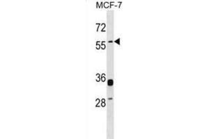 Western Blotting (WB) image for anti-Endogenous Retrovirus Group W, Member 1 (ERVW-1) antibody (ABIN2999163)