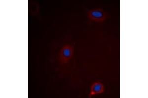 Immunofluorescent analysis of Ataxin 1 (pS775) staining in HEK293 cells.