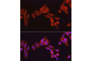 Immunofluorescence (IF) image for anti-Activating Transcription Factor 6 (ATF6) (AA 1-190) antibody (ABIN1512605)