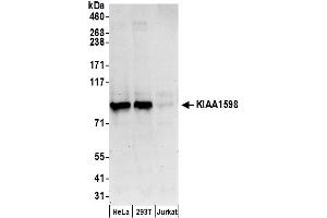 anti-Shootin-1 (SHTN1) (AA 575-625) antibody