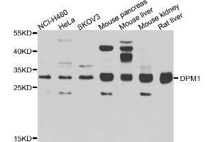 Western blot analysis of extracts of various cell lines, using DPM1 antibody (ABIN5975633) at 1/1000 dilution. (DPM1 antibody)
