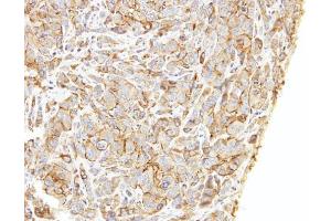IHC-P Image Immunohistochemical analysis of paraffin-embedded A549 xenograft, using LIMCH1, antibody at 1:500 dilution. (LIMCH1 antibody  (C-Term))