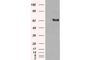 Western Blotting (WB) image for anti-EH-Domain Containing 2 (EHD2) (C-Term) antibody (ABIN2465640)