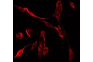 ABIN6275005 staining HepG2 by IF/ICC. (CLIC6 antibody  (Internal Region))