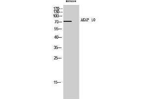 Western Blotting (WB) image for anti-A Kinase (PRKA) Anchor Protein 10 (AKAP10) (N-Term) antibody (ABIN3173722) (AKAP10 antibody  (N-Term))