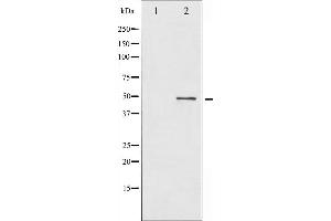 Western blot analysis of BLNK expression in etoposide treated 293 whole cell lysates,The lane on the left is treated with the antigen-specific peptide. (B-Cell Linker antibody  (N-Term))